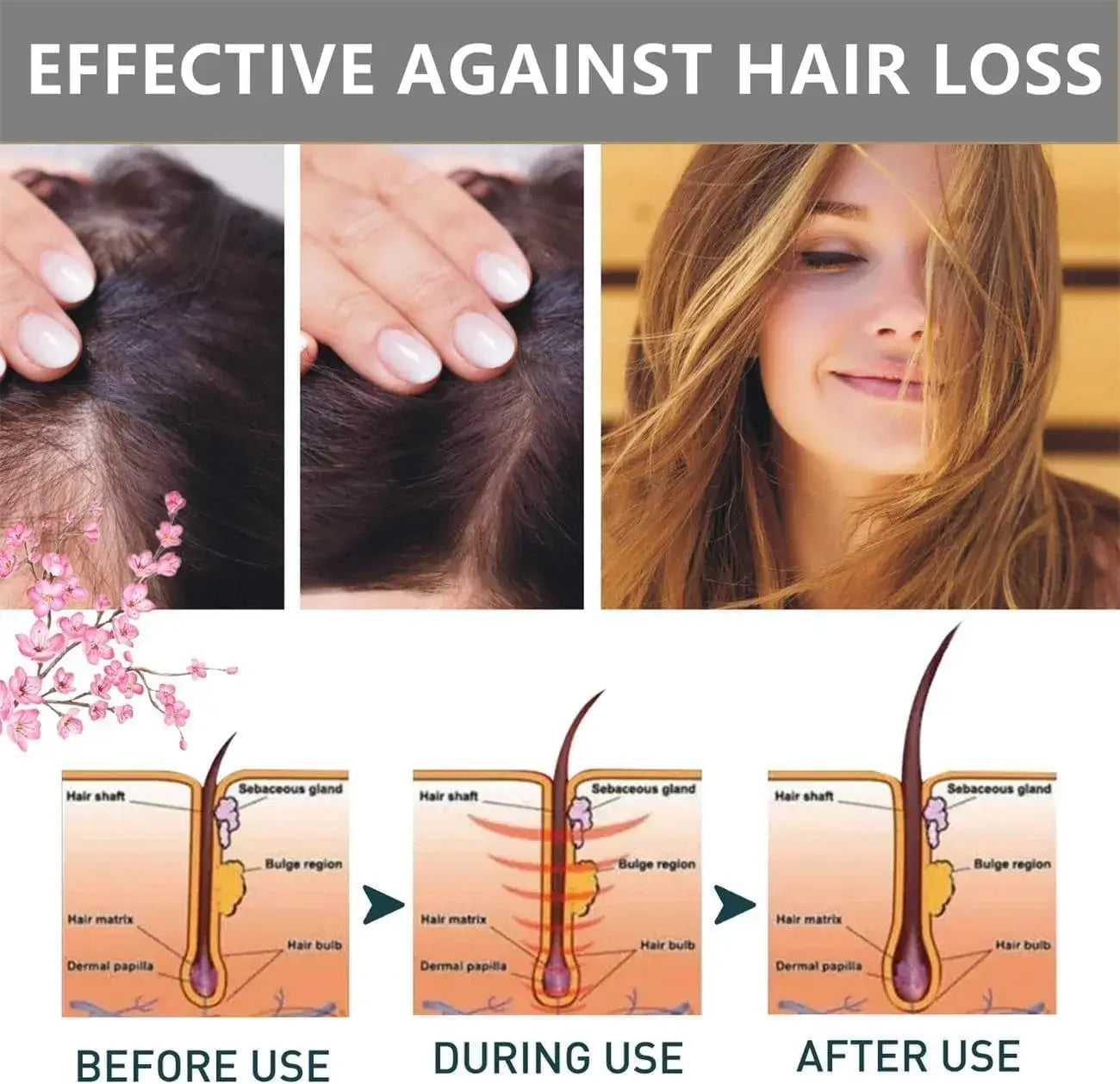 Sakura Japanese Shampoo For Hair Loss || شامبو ساكورا الياباني لعلاج تساقط الشعر - AllGoodzMart