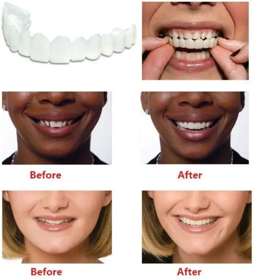 Comfort Fit Flexible Teeth || أسنان مرنة مريحة - AllGoodzMart