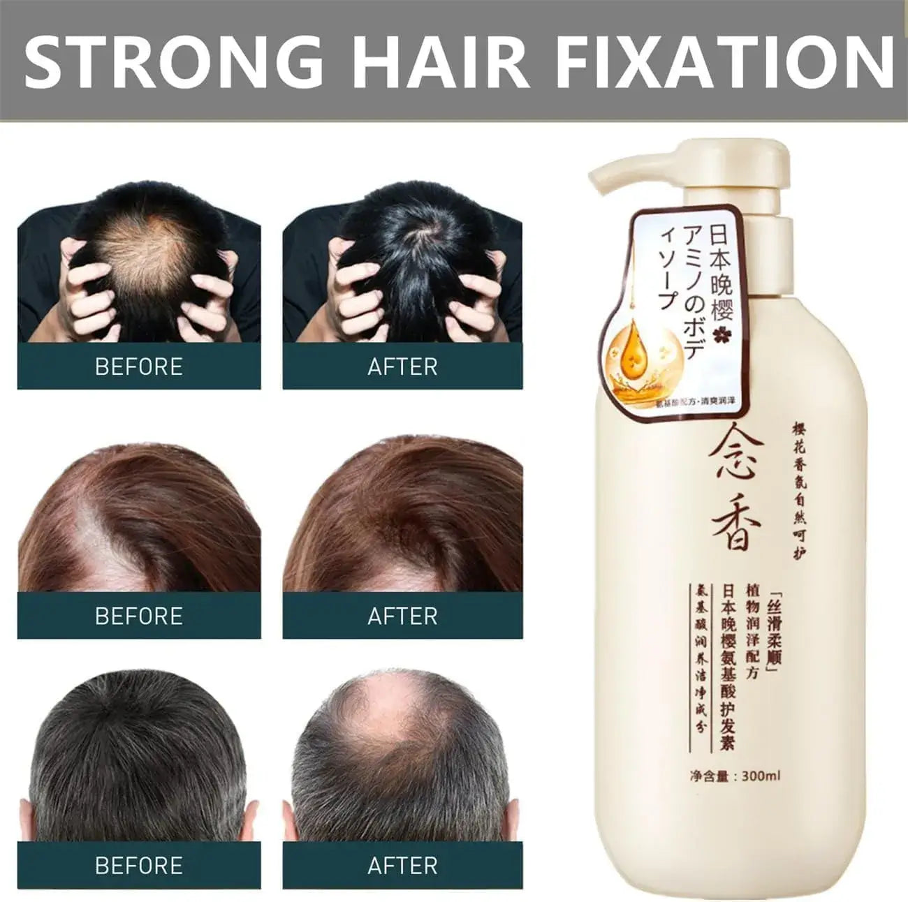 Sakura Japanese Shampoo For Hair Loss || شامبو ساكورا الياباني لعلاج تساقط الشعر - AllGoodzMart